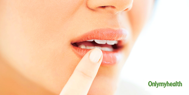 insidechappedlips
