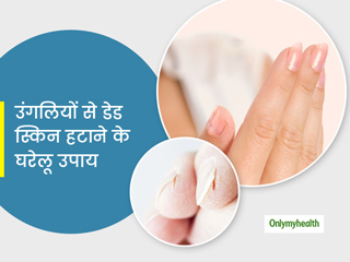 हाथ या चेहरे से पपड़ी की तरह निकलने लगे त्वचा की ऊपरी पर्त, तो आपके बड़े काम आएंगे ये घरेलू नुस्खे	