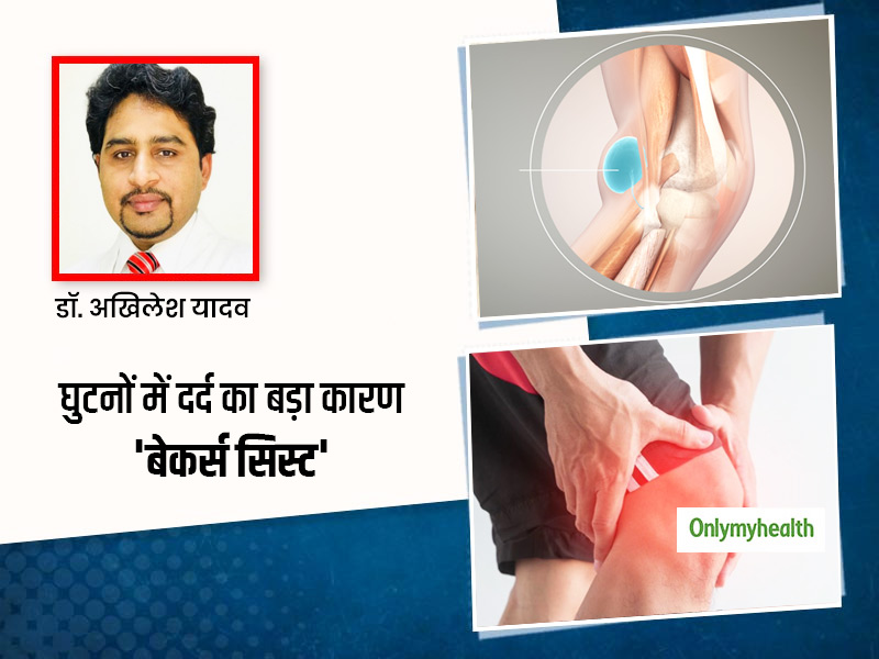 घुटनों में दर्द, जकड़न और सूजन का कारण हो सकता है 'बेकर्स सिस्ट', डॉक्टर से जानें इस बीमारी का कारण और इलाज