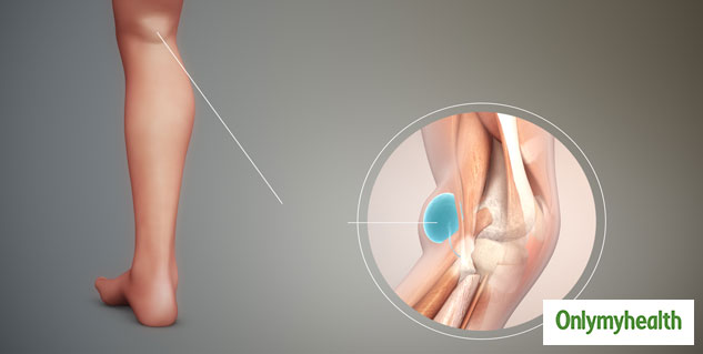 baker's cyst causes and symptoms