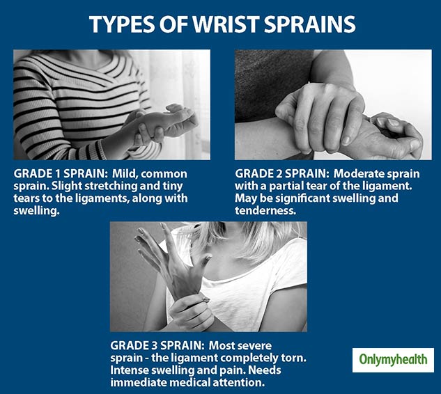 Sprains: Types, Symptoms & Treatment