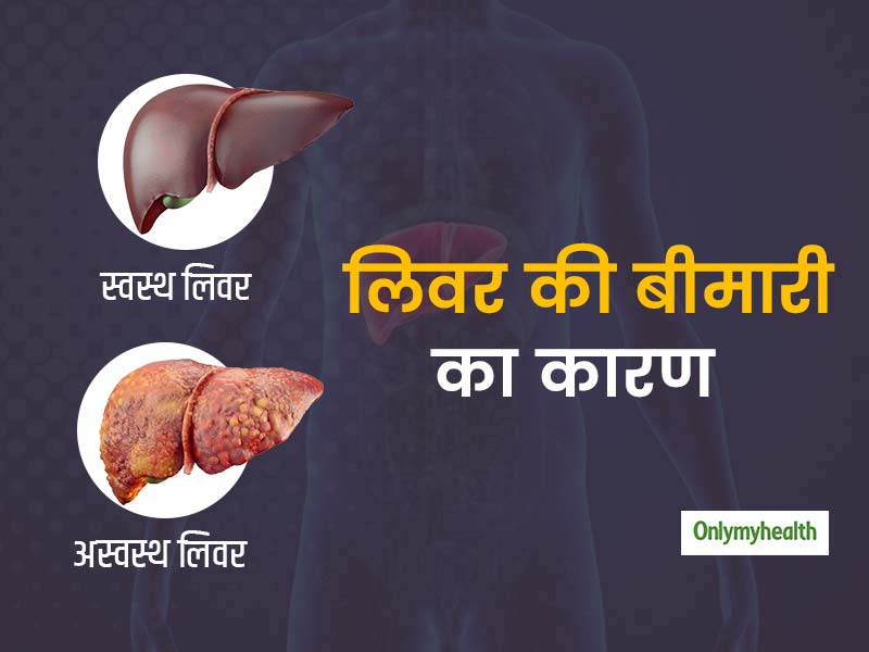 नशीली दवाओं के प्रयोग से हो सकती है लिवर की बीमारी, विस्‍तार से जानें इसके कारण और प्रकार