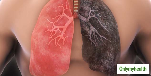 Lung Cancer