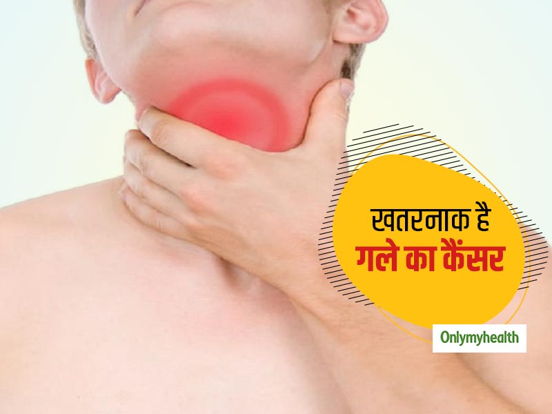 गले के कैंसर के लक्षणों को नजरअंदाज करना पड़ सकता है भारी, इन 10 संकेतों से पहचानें