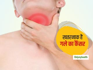 गले के कैंसर के लक्षणों को नजरअंदाज करना पड़ सकता है भारी, इन 10 संकेतों से पहचानें