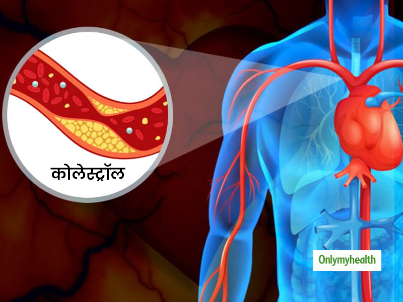 Excess Of Cholesterol Deposits In Arteries Can Lead Heart Problems In Hindi  | दिल की धड़कनों को रोक सकता है धमनियों में जमा कोलेस्‍ट्रॉल | Onlymyhealth
