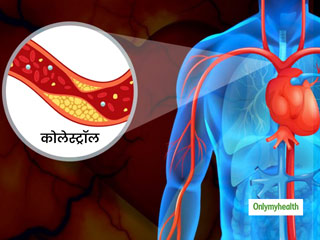दिल की धड़कनों को रोक सकता है धमनियों में जमा कोलेस्‍ट्रॉल, एक्‍सपर्ट से जानें इसका इलाज