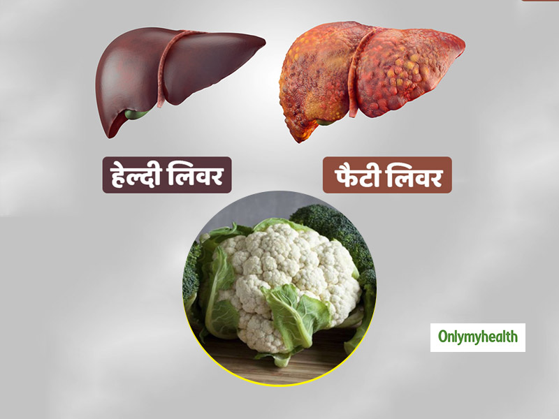 लिवर पर जमा फैट को हटा सकती है गोभी और ब्रोकोली जैसी सब्जियां, शोध में आया सामने 