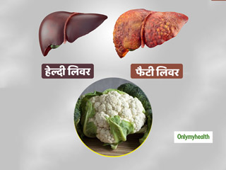 लिवर पर जमा फैट को हटा सकती है गोभी और ब्रोकोली जैसी सब्जियां, शोध में आया सामने 