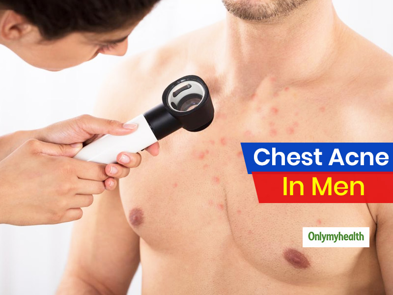 Grooming Guide For Men To Get Rid Of Chest Acne