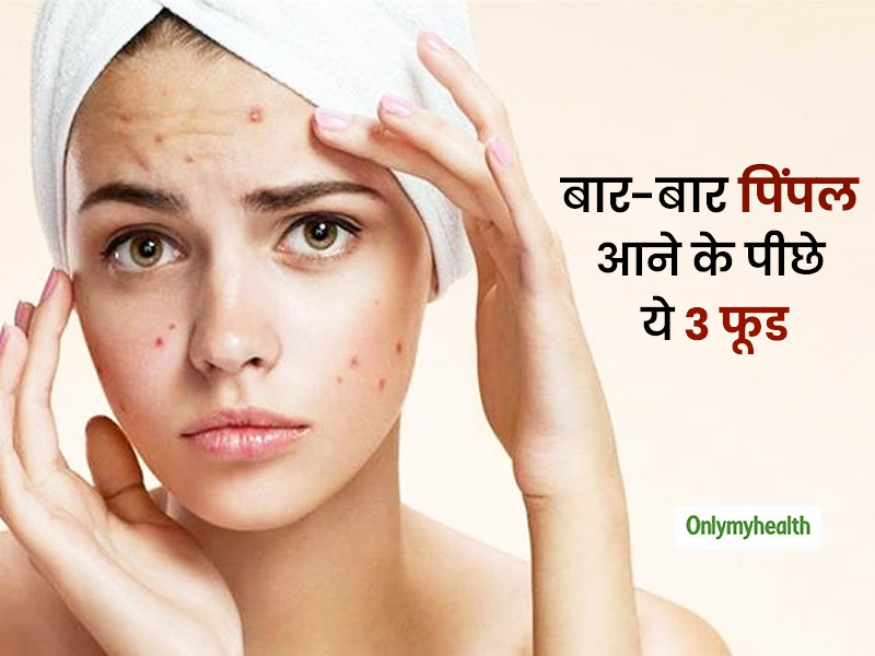 लड़का हो या लड़की इन 3 फूड के सेवन से बार-बार आ जाते हैं चेहरे पर पिंपल, खाना कर दें कम  
