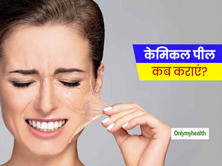 दाग-धब्बे मिटाने और त्वचा में निखार के लिए कराना चाहते हैं 'केमिकल पील', तो पहले जान लें ये जरूरी बातें