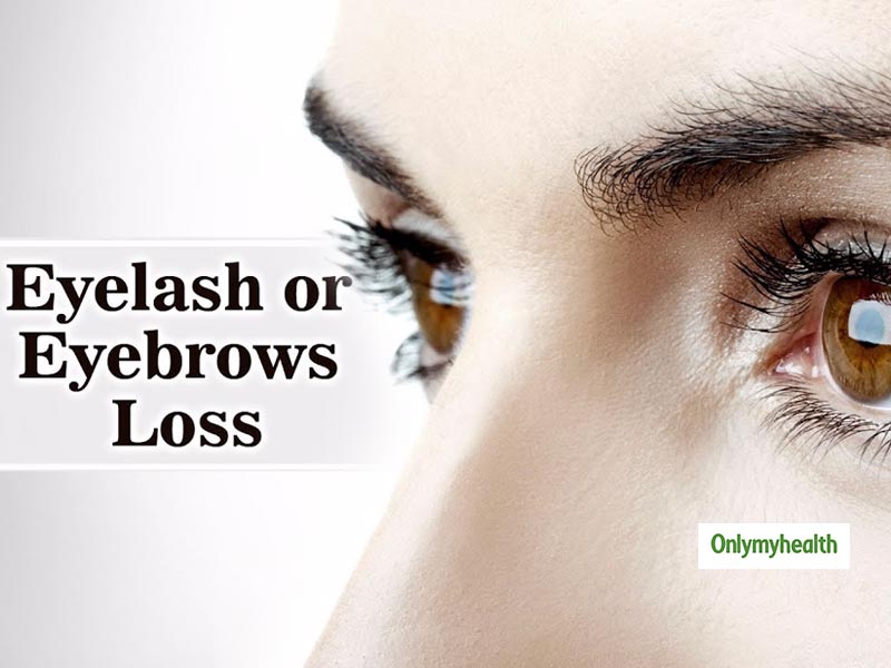 You Can Experience Eyebrow And Eyelash Loss Due To These Possible Reasons
