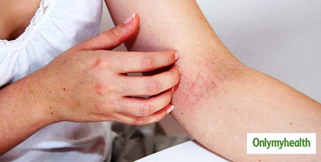 Skin Problems