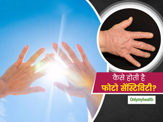 क्या है फोटो सेंस्टिविटी? जानें लक्षण, कारण और उपचार का तरीका 
