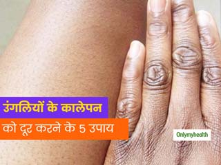 हाथ की उंगलियों के पोरों के कालेपन को इन 5 घरेलू नुस्खों से दूर करें और पाएं खूबसूरत हाथ