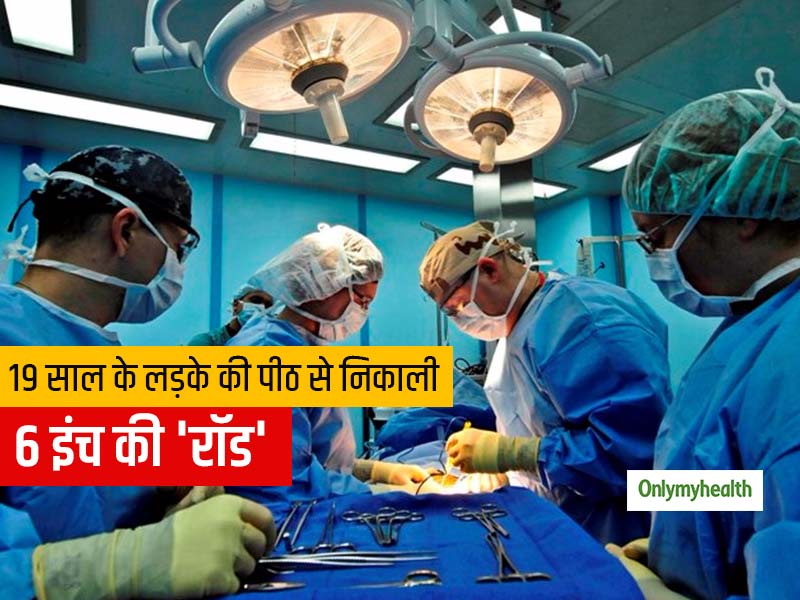 दिल्ली के डॉक्टरों ने 19 साल के लड़के की पीठ से निकाली 6 इंच की नुकीली रॉड, जानें क्या था पूरा मामला 