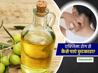 आप भी एक्जिमा रोग से हैं परेशान? जानें इसके लक्षण और बचाव के तरीके