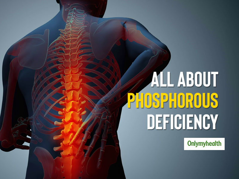 Phosphorus Deficiency: Know The Causes, Symptoms and Health Problems ...