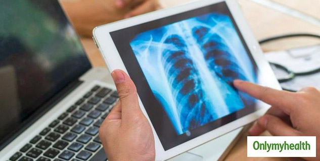 lungs-disease