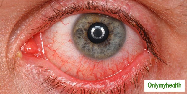 eyes