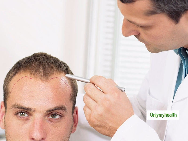 QR 678 Therapy: Can It Be A Boon For Those With Alopecia?