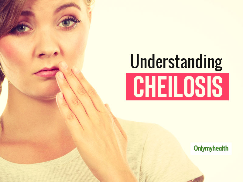 What Is Cheilosis? Everything You Need To Know About It