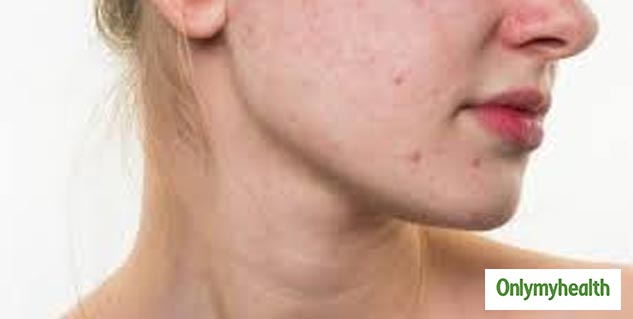 skin care