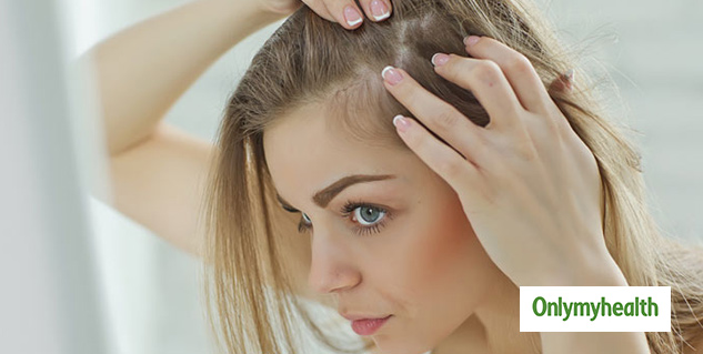hair fall problem