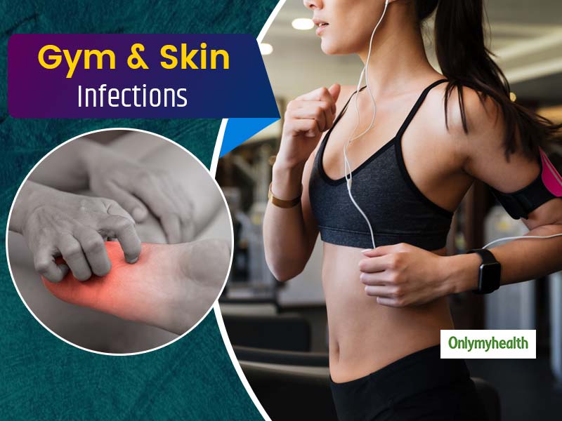 Skin Infections & Gym: Your Workout Is Ruining Your Skin In These Many Ways