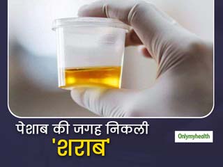 डायबिटीज और लिवर सिरोसिस से पीड़ित महिला के पेशाब में निकल रही शराब, डॉक्टरों ने बताया ये कारण   
