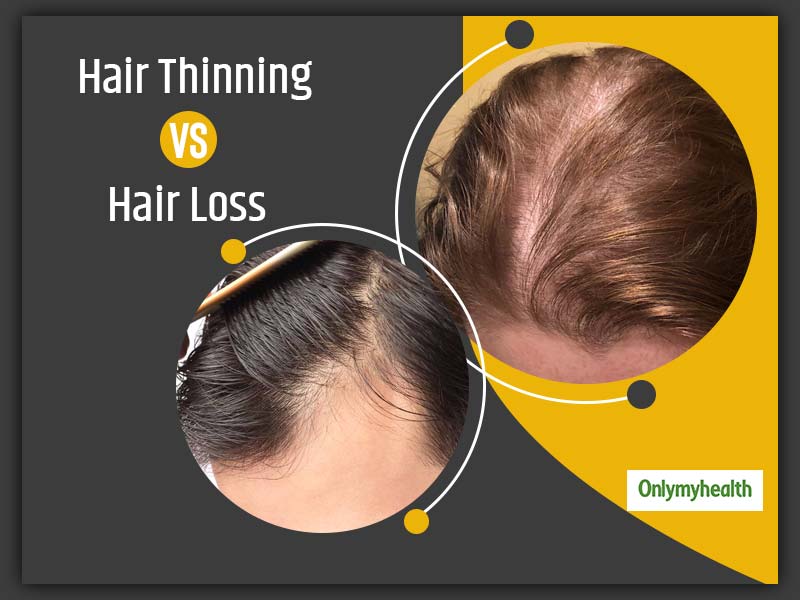 How To Differentiate Between Hair Thinning And Hair Loss?