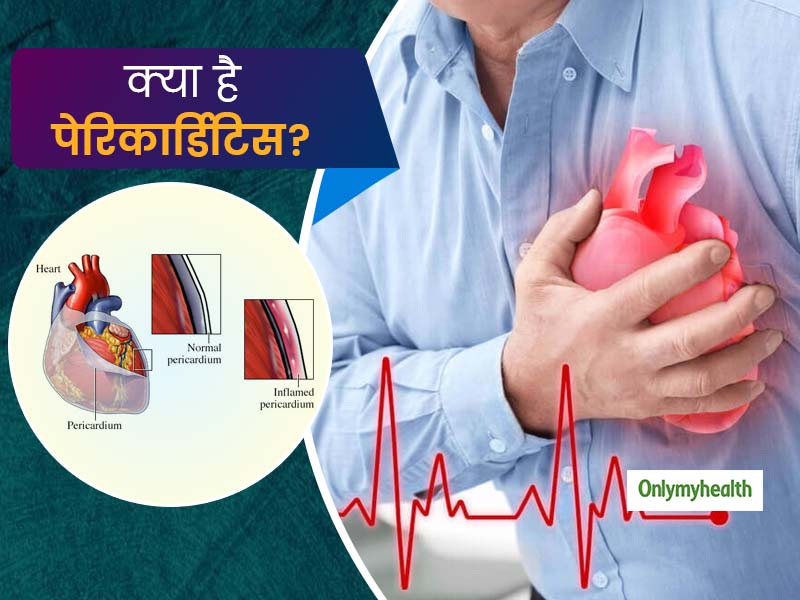 Heart Health: भारत में पेरिकार्डिटिस का बड़ा कारण है टीबी, डॉ. विवेक से जानें क्या है दिल से जुड़ी ये बीमारी