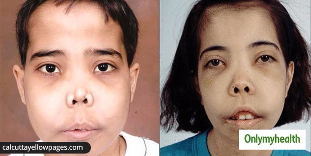 rare-diseases