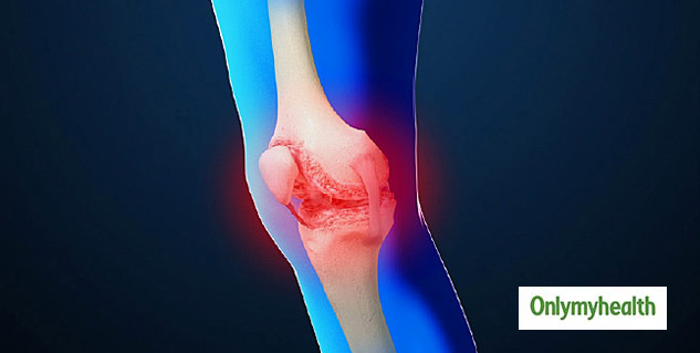 new-drug-reduces-disease-progression-in-knee-osteoarthritis-study-says