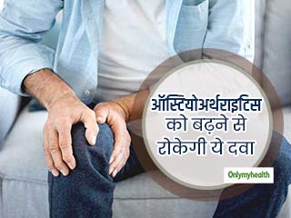 घुटने के ऑस्टियोअर्थराइटिस को बढ़ने से रोक सकती है ये दवा, शोधकर्ताओं ने एक अध्ययन में किया खुलासा