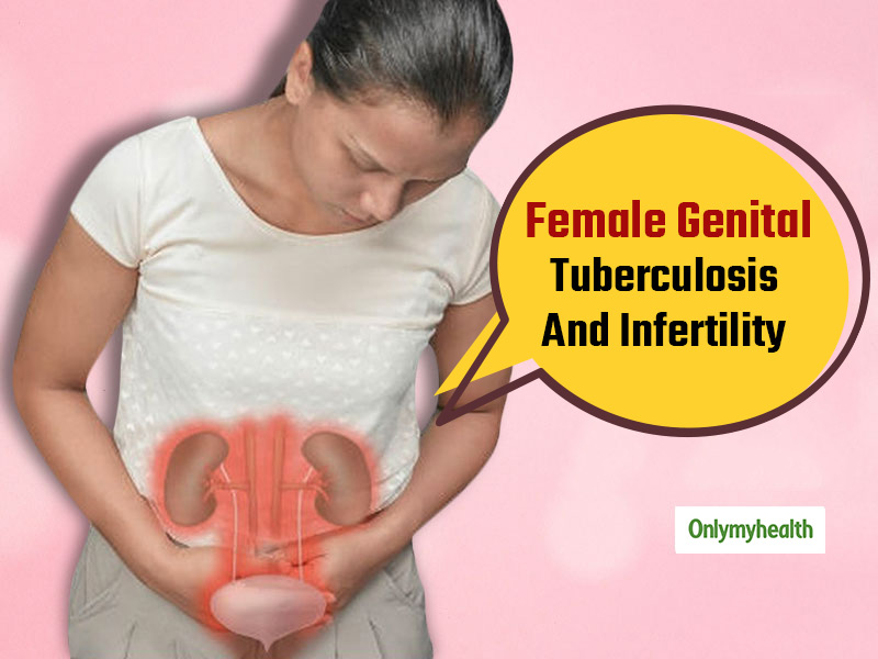 Female Genital Tuberculosis And Infertility Learn About Its Symptoms