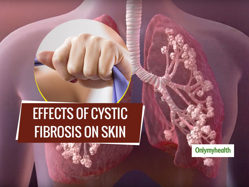 Why Cystic Fibrosis Makes The Skin Salty?