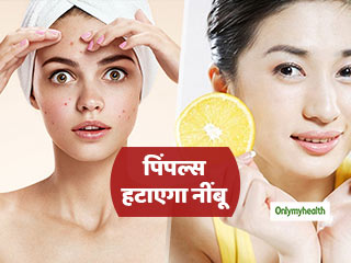 Lemon For Acne: पिंपल-फ्री स्किन पाने के लिए इन 3 तरीकों से करें नींबू का इस्‍तेमाल, जानें फायदे और नुकसान 