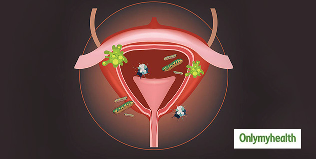 UTI Infection
