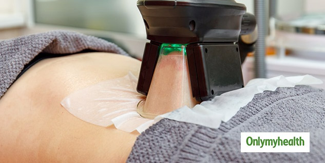 What is Fat Freezing