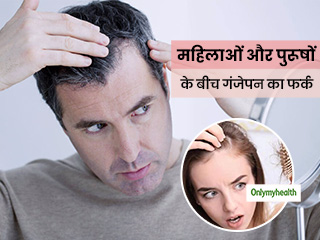 महिलाओं और पुरूषों के गंजेपन में होता है फर्क, जानें गंजेपन के लक्षणों में अंतर