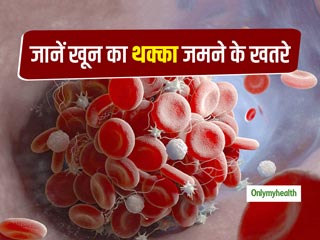 रक्त वाहिकाओं में खून का थक्का जमने (ब्लड क्लॉटिंग) के खतरे क्या हैं और इसे कैसे रोकें?