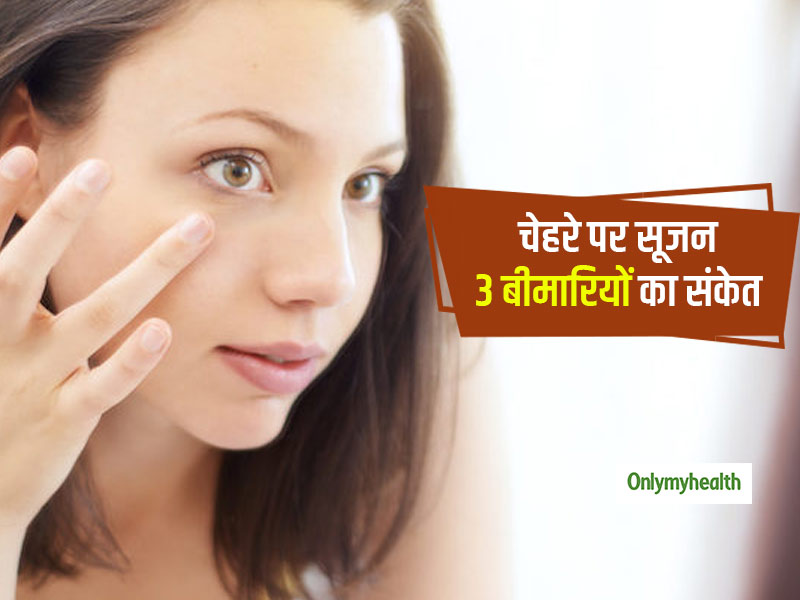 चेहरे पर सूजन आना है इन 3 बीमारियों का संकेत, जानें इन बीमारियों के लक्षण और बचाव के टिप्स  