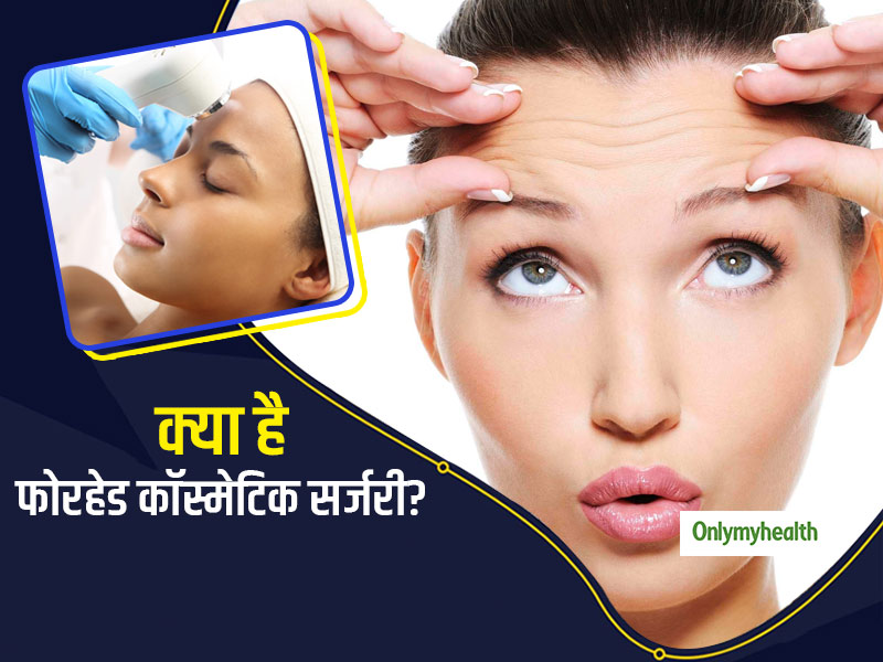 हेयरलाइन (फोरहेड) की कॉस्मेटिक सर्जरी करवाना गंजेपन कर सकता है इलाज, जानें इससे जुड़ी सभी जरूरी बातें