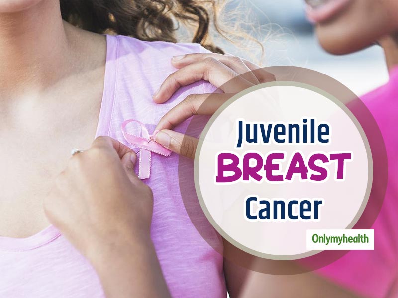 Juvenile Breast Cancer: Here Are Some Lesser Known Facts About It