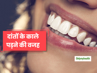 क्या आपके भी मसूड़े हैं काले? जानें 4 कारण जिनकी वजह से काले हो जाते हैं मसूड़े