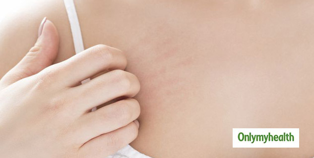 Excessive Itching Around The Breasts Is An Initial Sign Of 'Nipple