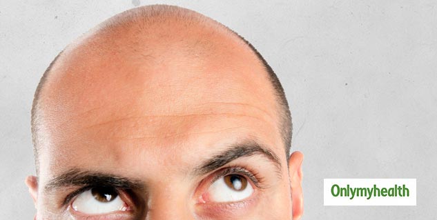 hairfall