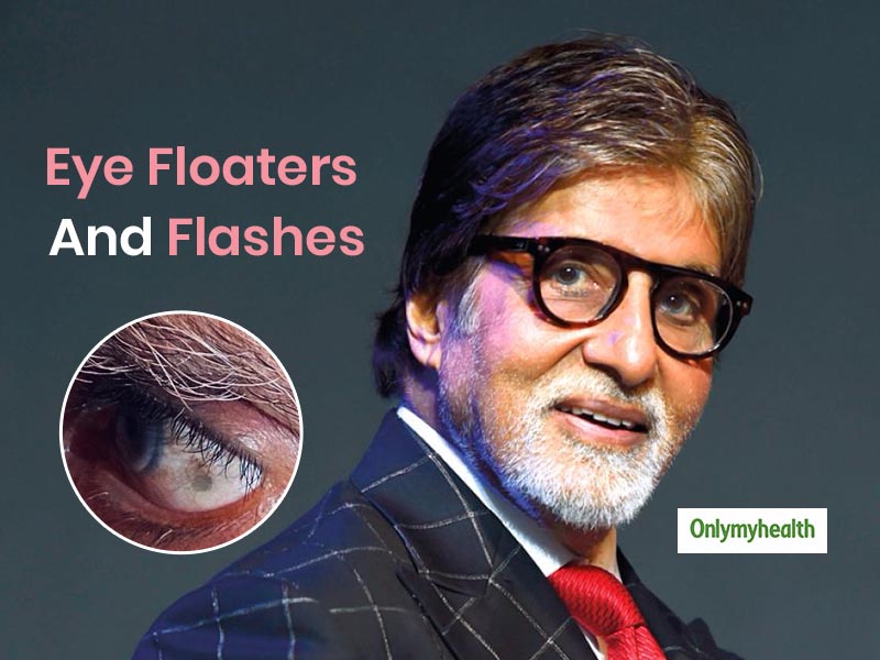 Amitabh Bachchan Latest Health News: Know All About Eye Floaters And Flashes 